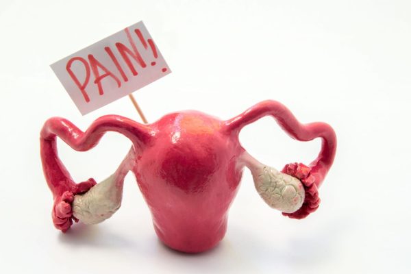 86559367 - illustration concept of pain symptom or syndrome in pathologies and diseases of female genitals as pms, endometriosis. anatomical model of uterus is next to poster on which written in red word pain